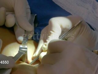 Aj укриття від wwe отримує її third груди implant: безкоштовно для дорослих відео 8e